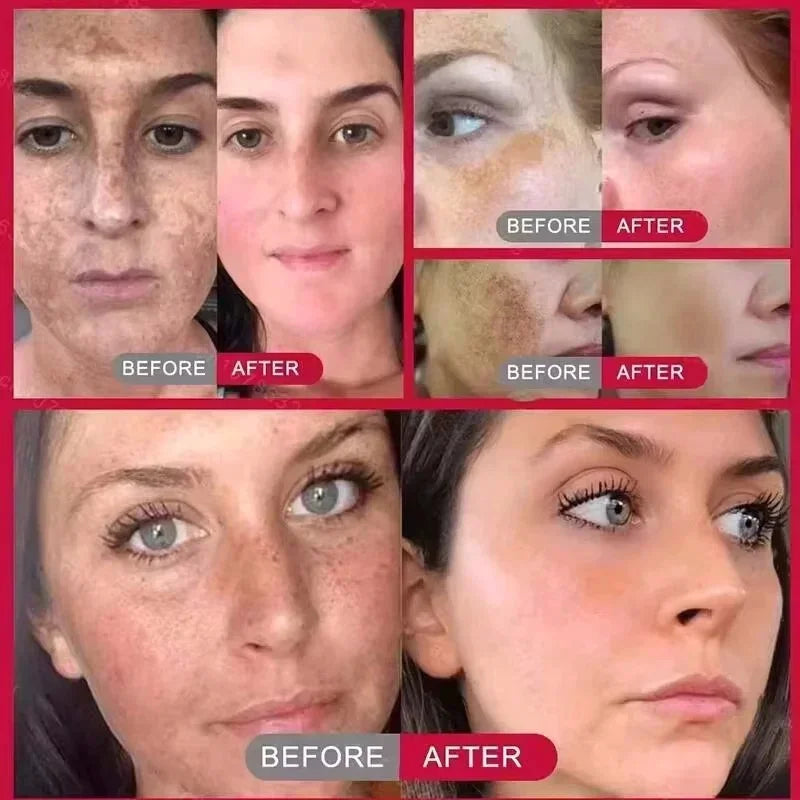 Spot Clear Fast Brightening Repair Cr